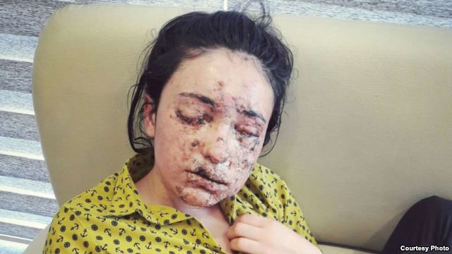 Close up of young woman with shrapnel injuries to her face.